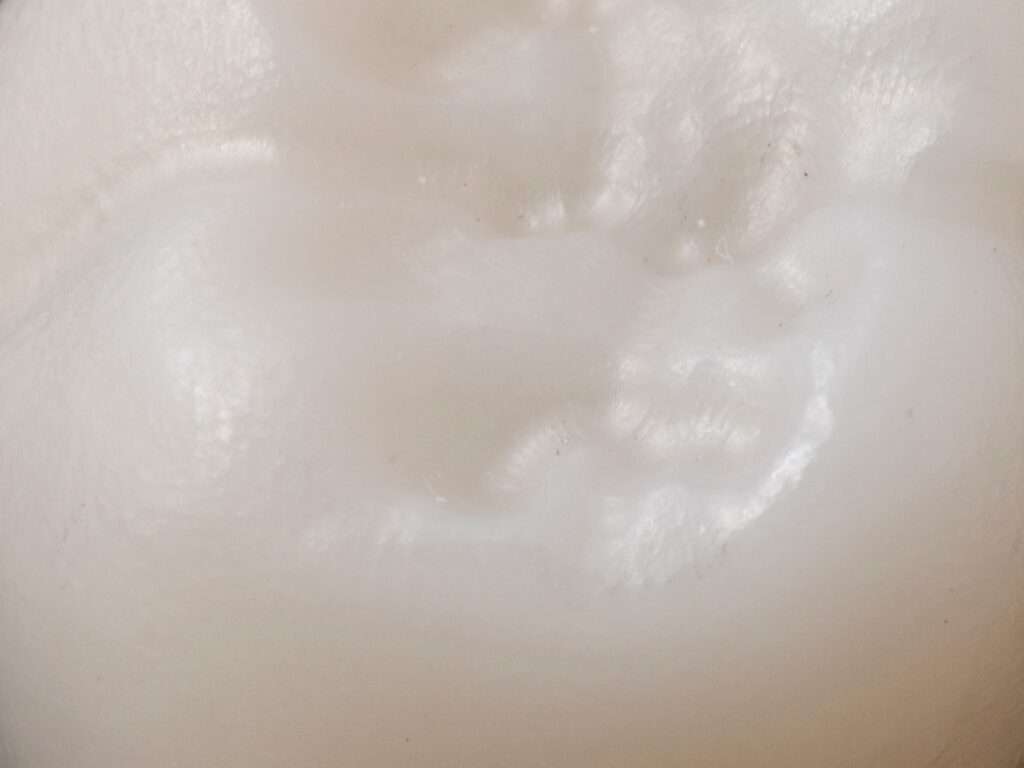 Füllungen Zahnarzt Rheinfelden